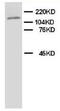 CD49D antibody, AP23259PU-N, Origene, Western Blot image 