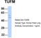 Elongation factor Tu, mitochondrial antibody, TA344290, Origene, Western Blot image 