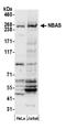 Neuroblastoma-amplified sequence antibody, A305-636A-M, Bethyl Labs, Western Blot image 