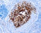 Keratin 17 antibody, GTX73698, GeneTex, Immunohistochemistry paraffin image 