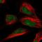 TOG Array Regulator Of Axonemal Microtubules 2 antibody, NBP1-93765, Novus Biologicals, Immunocytochemistry image 