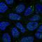 GalNAc-T14 antibody, NBP2-56187, Novus Biologicals, Immunocytochemistry image 