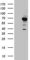 Glyceronephosphate O-Acyltransferase antibody, LS-C792678, Lifespan Biosciences, Western Blot image 