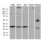 Clathrin Light Chain A antibody, LS-C795026, Lifespan Biosciences, Western Blot image 