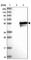 Family With Sequence Similarity 170 Member A antibody, HPA037902, Atlas Antibodies, Western Blot image 