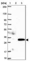 CKLF Like MARVEL Transmembrane Domain Containing 4 antibody, NBP1-84456, Novus Biologicals, Western Blot image 
