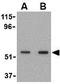 SKI Like Proto-Oncogene antibody, GTX16977, GeneTex, Western Blot image 