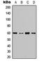 Akt antibody, LS-C358908, Lifespan Biosciences, Western Blot image 