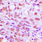 Sentrin-specific protease 2 antibody, LS-C353527, Lifespan Biosciences, Immunohistochemistry paraffin image 