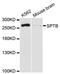 Spectrin Beta, Erythrocytic antibody, LS-C748109, Lifespan Biosciences, Western Blot image 