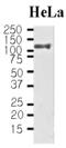 HSPH1 antibody, GTX50045, GeneTex, Western Blot image 