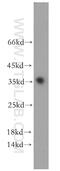 Putative type-1 protein phosphatase inhibitor 4 antibody, 11969-1-AP, Proteintech Group, Western Blot image 