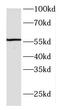 F-Box Protein 5 antibody, FNab03047, FineTest, Western Blot image 
