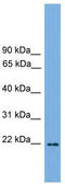 Jun Dimerization Protein 2 antibody, TA329961, Origene, Western Blot image 