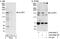 Cytoplasmic Linker Associated Protein 1 antibody, A302-086A, Bethyl Labs, Immunoprecipitation image 