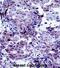 Cortactin antibody, abx027564, Abbexa, Immunohistochemistry paraffin image 