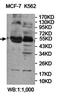 2'-5'-Oligoadenylate Synthetase 1 antibody, orb78226, Biorbyt, Western Blot image 