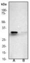 Caspase 3 antibody, TA300422, Origene, Western Blot image 