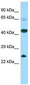 Calcium-binding and spermatid-specific protein 1 antibody, TA331685, Origene, Western Blot image 