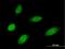 MMS19 nucleotide excision repair protein homolog antibody, H00064210-B01P, Novus Biologicals, Immunofluorescence image 