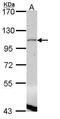 Phosphatidate phosphatase LPIN1 antibody, PA5-28704, Invitrogen Antibodies, Western Blot image 