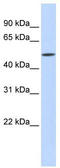 Interferon Induced Protein With Tetratricopeptide Repeats 2 antibody, TA346292, Origene, Western Blot image 