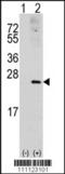 Ras-related C3 botulinum toxin substrate 1 antibody, TA302136, Origene, Western Blot image 