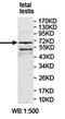 Ectonucleoside Triphosphate Diphosphohydrolase 4 antibody, orb78294, Biorbyt, Western Blot image 