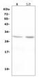 Erythropoietin antibody, A00484-2, Boster Biological Technology, Western Blot image 