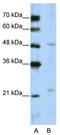 WD Repeat Domain 12 antibody, TA346002, Origene, Western Blot image 