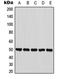 Pantothenate kinase 2, mitochondrial antibody, orb215296, Biorbyt, Western Blot image 