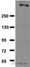 Dystrophin antibody, ab7164, Abcam, Western Blot image 