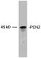 Presenilin Enhancer, Gamma-Secretase Subunit antibody, LS-C202969, Lifespan Biosciences, Western Blot image 