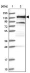 Ring Finger Protein 40 antibody, PA5-59519, Invitrogen Antibodies, Western Blot image 