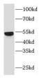 Dipeptidyl Peptidase 7 antibody, FNab02521, FineTest, Western Blot image 
