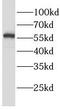 Leucine-rich repeat LGI family member 3 antibody, FNab04762, FineTest, Western Blot image 