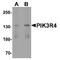 Phosphoinositide-3-Kinase Regulatory Subunit 4 antibody, TA349094, Origene, Western Blot image 