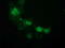 ATPase H+ Transporting V1 Subunit F antibody, M12432-1, Boster Biological Technology, Immunofluorescence image 