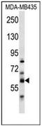 Phosphatidylserine Synthase 2 antibody, AP53496PU-N, Origene, Western Blot image 