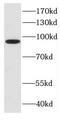Cilia And Flagella Associated Protein 47 antibody, FNab02109, FineTest, Western Blot image 