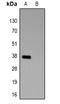 Glutathione-S-Transferase Tag antibody, LS-C368988, Lifespan Biosciences, Western Blot image 