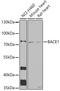 Beta-Secretase 1 antibody, A00322-2, Boster Biological Technology, Western Blot image 