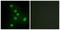 Nuclear Receptor Subfamily 2 Group F Member 6 antibody, LS-C118774, Lifespan Biosciences, Immunofluorescence image 