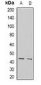 AlkB Homolog 1, Histone H2A Dioxygenase antibody, orb341014, Biorbyt, Western Blot image 