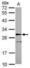 Cyclin-dependent kinase 10 antibody, GTX115974, GeneTex, Western Blot image 