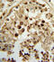 Hydroxysteroid 17-Beta Dehydrogenase 3 antibody, 63-983, ProSci, Immunohistochemistry paraffin image 