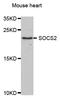 Suppressor of cytokine signaling 2 antibody, A5703, ABclonal Technology, Western Blot image 