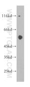 Angiopoietin Like 1 antibody, 14709-1-AP, Proteintech Group, Western Blot image 