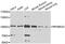 Ribosomal Protein S6 Kinase A3 antibody, STJ110928, St John