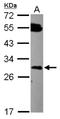 Defective In Cullin Neddylation 1 Domain Containing 2 antibody, NBP2-16118, Novus Biologicals, Western Blot image 